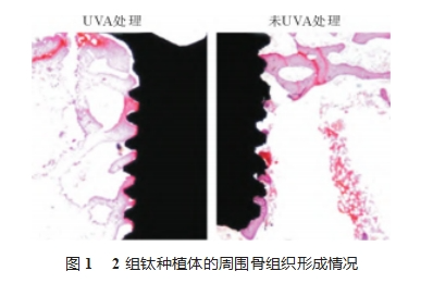紫外线光功能化对二氧化钛纳米管表面改性钛种植体骨结合的影响
