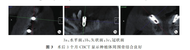 640_wx_fmt=png&from=appmsg&tp=webp&wxfrom=5&wx_lazy=1&wx_co=1 (2).png 640_wx_fmt=png&from=appmsg&tp=webp&wxfrom=5&wx_lazy=1&wx_co=1 (2).png